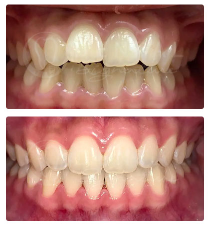 Phuket Dental 